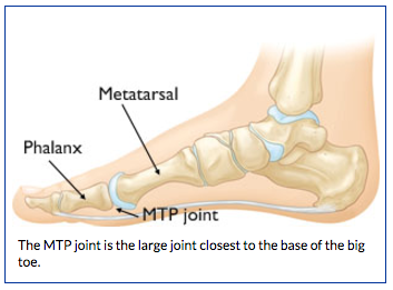 Great Toe Mtp Joint