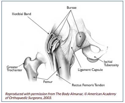 solopgang Arrowhead vinkel Snapping Hip Syndrome | BoulderCentre for Orthopedics & Spine