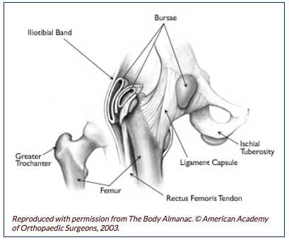 Hip Bursitis / Tendonitis — Empower