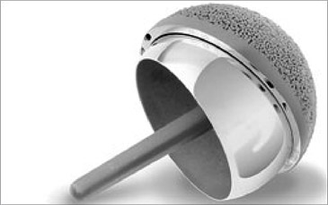The implant