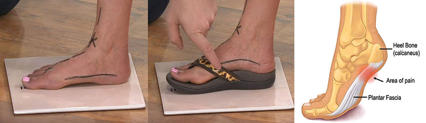 Flip flops for painful feet sale
